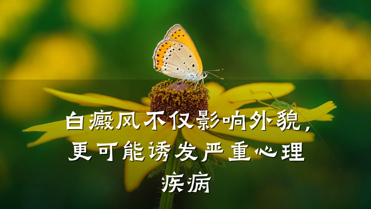 白癜风不仅影响外貌，更可能诱发严重心理疾病
